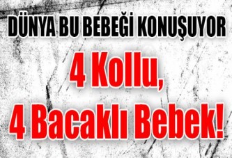 4 Kollu, 4 Bacaklı Bebek!