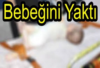 45 Günlük Bebek Sıcak Sudan Haşlandı