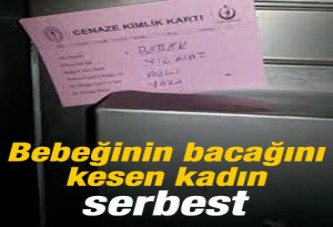 Bebeğinin bacağını kesen kadın serbest