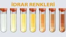 İdrar Renklerinin Anlamı Nedir?