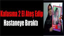 Kafasına 2 El Ateş Edip Hastaneye Bıraktı