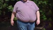 Obezite Birçok Hastalığı Tetikliyor!