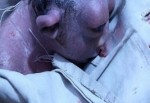 Sıradışı bebek 2 gün hayatta kalabildi!