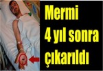 Vücudundaki sekizinci mermi 4 yıl sonra çıkarıldı